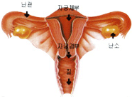 자궁경부암이란?